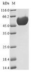 PNLIPRP1 Protein - (Tris-Glycine gel) Discontinuous SDS-PAGE (reduced) with 5% enrichment gel and 15% separation gel.