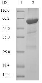 PNLIPRP1 Protein - (Tris-Glycine gel) Discontinuous SDS-PAGE (reduced) with 5% enrichment gel and 15% separation gel.