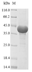 PPP1CA / PP1-Alpha Protein - (Tris-Glycine gel) Discontinuous SDS-PAGE (reduced) with 5% enrichment gel and 15% separation gel.