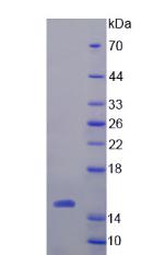 Procalcitonin Protein - Recombinant Procalcitonin (PCT) by SDS-PAGE