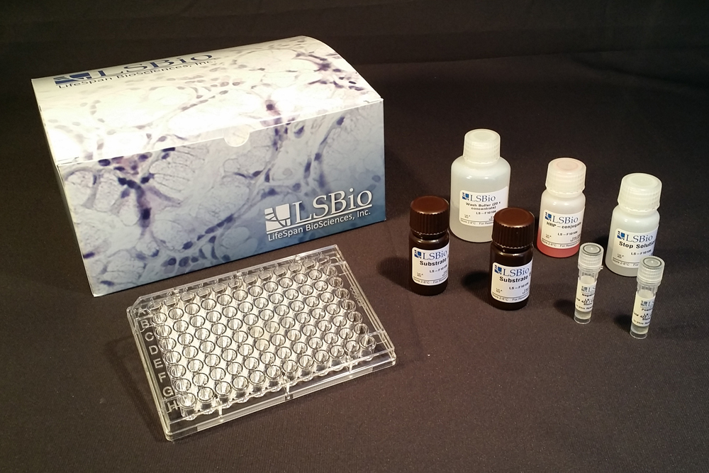 SELP / P-Selectin / CD62P ELISA Kit