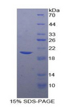 TIMP1 Protein - Recombinant Tissue Inhibitors Of Metalloproteinase 1 By SDS-PAGE