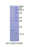 TIMP2 Protein - Recombinant Tissue Inhibitors Of Metalloproteinase 2 By SDS-PAGE