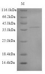 Trypsin Protein - (Tris-Glycine gel) Discontinuous SDS-PAGE (reduced) with 5% enrichment gel and 15% separation gel.