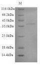 Trypsin Protein - (Tris-Glycine gel) Discontinuous SDS-PAGE (reduced) with 5% enrichment gel and 15% separation gel.