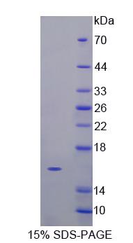 VEGFC Protein - Recombinant  Vascular Endothelial Growth Factor C By SDS-PAGE