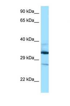 DOHH Antibody - DOHH antibody Western blot of 435S Cell lysate. Antibody concentration 1 ug/ml.  This image was taken for the unconjugated form of this product. Other forms have not been tested.