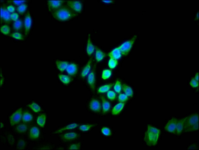 DOHH Antibody - Immunofluorescence staining of PC3 cells diluted at 1:166, counter-stained with DAPI. The cells were fixed in 4% formaldehyde, permeabilized using 0.2% Triton X-100 and blocked in 10% normal Goat Serum. The cells were then incubated with the antibody overnight at 4°C.The Secondary antibody was Alexa Fluor 488-congugated AffiniPure Goat Anti-Rabbit IgG (H+L).