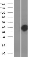 DOHH Protein - Western validation with an anti-DDK antibody * L: Control HEK293 lysate R: Over-expression lysate
