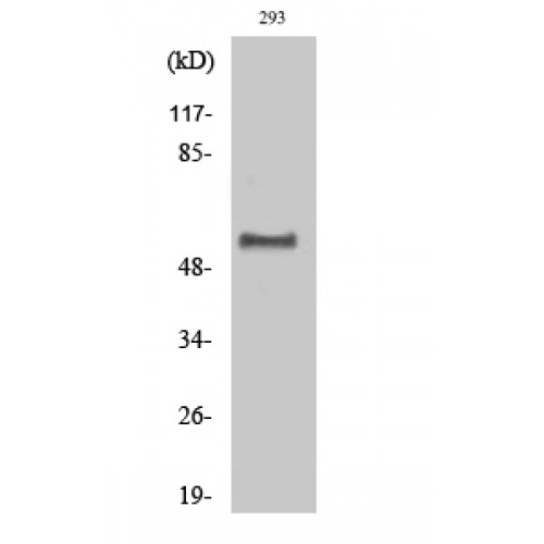 DOK1 Antibody - Western blot of Phospho-Dok-1 (Y362) antibody