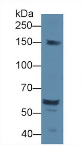 DOK1 Antibody - Western Blot; Sample: Rat Serum; Primary Ab: 1µg/ml Rabbit Anti-Rat DOK1 Antibody Second Ab: 0.2µg/mL HRP-Linked Caprine Anti-Rabbit IgG Polyclonal Antibody