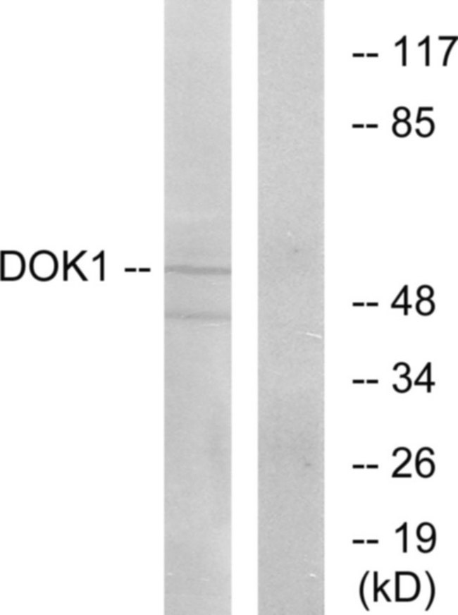 DOK1 Antibody - Western blot analysis of lysates from Jurkat cells, using p62 Dok Antibody. The lane on the right is blocked with the synthesized peptide.