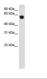 DOK1 Antibody - Transfected 293T Cell Lysate.  This image was taken for the unconjugated form of this product. Other forms have not been tested.