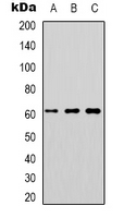 DOK1 Antibody - Western blot analysis of DOK1 expression in K562 (A); Jurkat (B); RAW264.7 (C) whole cell lysates.