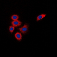 DOK1 Antibody - Immunofluorescent analysis of DOK1 staining in K562 cells. Formalin-fixed cells were permeabilized with 0.1% Triton X-100 in TBS for 5-10 minutes and blocked with 3% BSA-PBS for 30 minutes at room temperature. Cells were probed with the primary antibody in 3% BSA-PBS and incubated overnight at 4 deg C in a humidified chamber. Cells were washed with PBST and incubated with a DyLight 594-conjugated secondary antibody (red) in PBS at room temperature in the dark. DAPI was used to stain the cell nuclei (blue).