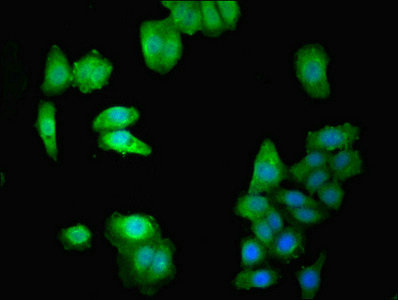 DOK1 Antibody - Immunofluorescent analysis of HepG2 cells using DOK1 Antibody at dilution of 1:100 and Alexa Fluor 488-congugated AffiniPure Goat Anti-Rabbit IgG(H+L)