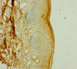 DOK1 Antibody - Immunohistochemistry of paraffin-embedded human skin tissue using DOK1 Antibody at dilution of 1:100