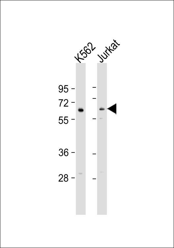 DOK1 Antibody - All lanes: Anti-DOK1 Antibody at 1:1000 dilution. Lane 1: K562 whole cell lysate. Lane 2: Jurkat whole cell lysate Lysates/proteins at 20 ug per lane. Secondary Goat Anti-Rabbit IgG, (H+L), Peroxidase conjugated at 1:10000 dilution. Predicted band size: 52 kDa. Blocking/Dilution buffer: 5% NFDM/TBST.