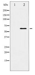 DOK1 Antibody - Western blot of p62 Dok expression in Jurkat whole cell lysates,The lane on the left is treated with the antigen-specific peptide.