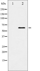 DOK1 Antibody - Western blot analysis of p62 Dok expression in Jurkat whole cells lysates. The lane on the left is treated with the antigen-specific peptide.
