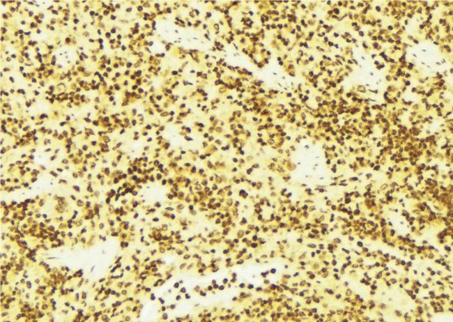 DOK1 Antibody - 1:100 staining mouse spleen tissue by IHC-P. The sample was formaldehyde fixed and a heat mediated antigen retrieval step in citrate buffer was performed. The sample was then blocked and incubated with the antibody for 1.5 hours at 22°C. An HRP conjugated goat anti-rabbit antibody was used as the secondary.