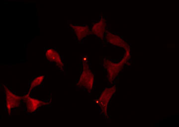 DOK1 Antibody - Staining HeLa cells by IF/ICC. The samples were fixed with PFA and permeabilized in 0.1% Triton X-100, then blocked in 10% serum for 45 min at 25°C. The primary antibody was diluted at 1:200 and incubated with the sample for 1 hour at 37°C. An Alexa Fluor 594 conjugated goat anti-rabbit IgG (H+L) Ab, diluted at 1/600, was used as the secondary antibody.