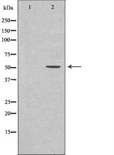 DOK1 Antibody - Western blot analysis of Jurkat whole cells lysates using DOK1 antibody. The lane on the left is treated with the antigen-specific peptide.