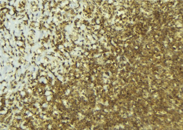 DOK1 Antibody - 1:100 staining mouse pancreas tissue by IHC-P. The sample was formaldehyde fixed and a heat mediated antigen retrieval step in citrate buffer was performed. The sample was then blocked and incubated with the antibody for 1.5 hours at 22°C. An HRP conjugated goat anti-rabbit antibody was used as the secondary.