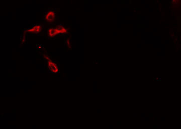 DOK1 Antibody - Staining HeLa cells by IF/ICC. The samples were fixed with PFA and permeabilized in 0.1% Triton X-100, then blocked in 10% serum for 45 min at 25°C. The primary antibody was diluted at 1:200 and incubated with the sample for 1 hour at 37°C. An Alexa Fluor 594 conjugated goat anti-rabbit IgG (H+L) antibody, diluted at 1/600, was used as secondary antibody.
