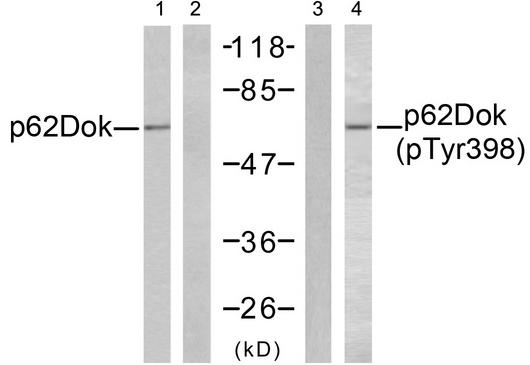 DOK1 Antibody - Western blot analysis of extracts from K562 cells, untreated or treated with Starvation (24 hours), using p62Dok (Ab-398) antibody (Line 1 and 2) and p62Dok (Phospho-Tyr398) antibody (Line 3 and 4).