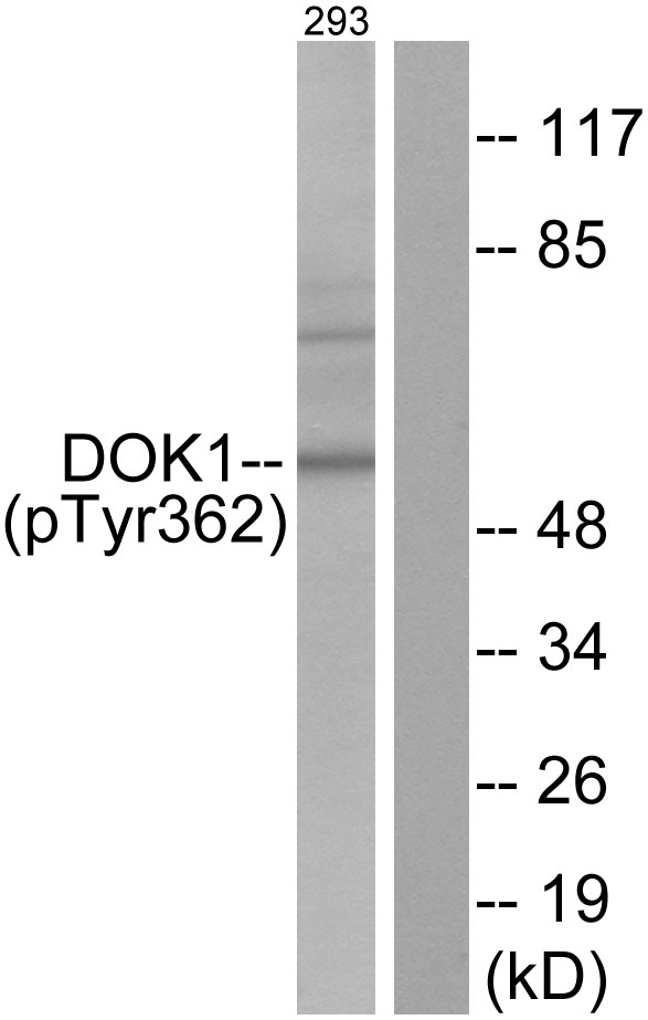 DOK1 Antibody - Western blot analysis of lysates from 293 cells, using p62 Dok (Phospho-Tyr362) Antibody. The lane on the right is blocked with the phospho peptide.
