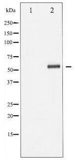 DOK1 Antibody - Western blot of p62 Dok phosphorylation expression in Jurkat whole cell lysates,The lane on the left is treated with the antigen-specific peptide.