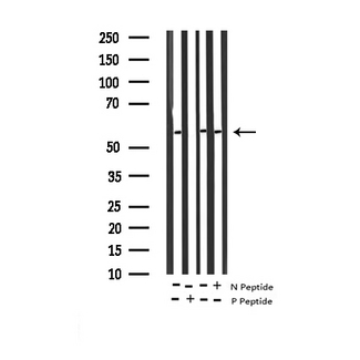 DOK1 Antibody - Western blot analysis of Phospho-p62 Dok (Tyr362) expression in various lysates