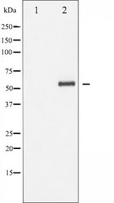 DOK1 Antibody - Western blot analysis of p62 Dok phosphorylation expression in Jurkat whole cells lysates. The lane on the left is treated with the antigen-specific peptide.