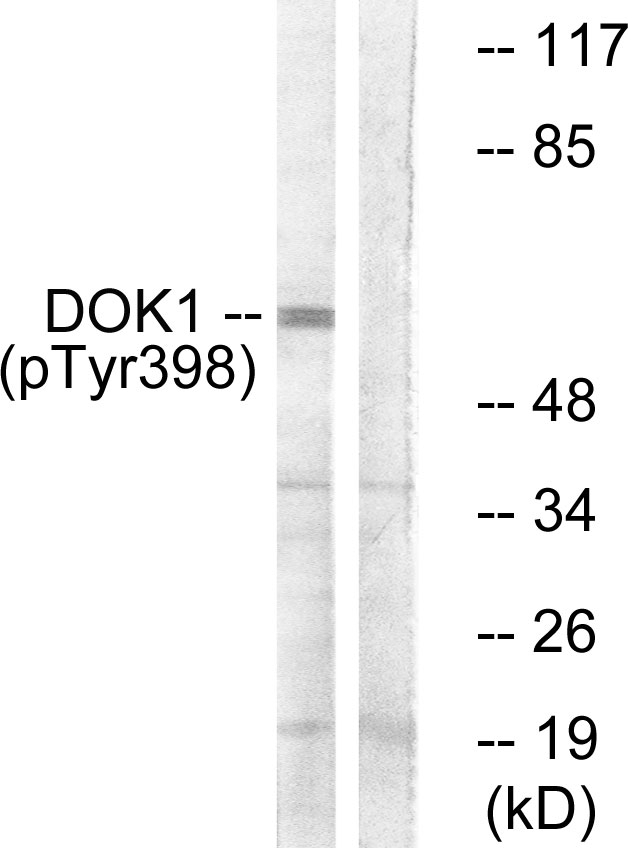 DOK1 Antibody - Western blot analysis of lysates from K562 cells treated with Starvation 24h, using p62 Dok (Phospho-Tyr398) Antibody. The lane on the right is blocked with the phospho peptide.