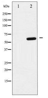 DOK1 Antibody - Western blot of p62 Dok phosphorylation expression in K562 whole cell lysates,The lane on the left is treated with the antigen-specific peptide.