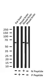 DOK1 Antibody - Western blot analysis of Phospho-p62 Dok (Tyr398) expression in various lysates