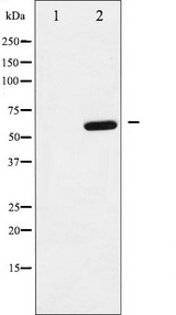 DOK1 Antibody - Western blot analysis of p62 Dok phosphorylation expression in K562 whole cells lysates. The lane on the left is treated with the antigen-specific peptide.