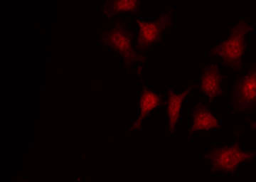 DOK1 Antibody - Staining HeLa cells by IF/ICC. The samples were fixed with PFA and permeabilized in 0.1% Triton X-100, then blocked in 10% serum for 45 min at 25°C. The primary antibody was diluted at 1:200 and incubated with the sample for 1 hour at 37°C. An Alexa Fluor 594 conjugated goat anti-rabbit IgG (H+L) Ab, diluted at 1/600, was used as the secondary antibody.