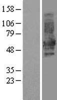 DOK1 Protein - Western validation with an anti-DDK antibody * L: Control HEK293 lysate R: Over-expression lysate