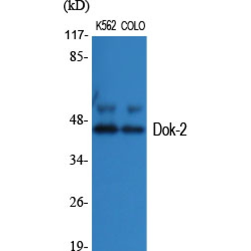 DOK2 Antibody - Western blot of Dok-2 antibody