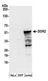 DOK2 Antibody - Detection of human DOK2 by western blot. Samples: Whole cell lysate (50 µg) from HeLa, HEK293T, and Jurkat cells prepared using NETN lysis buffer. Antibody: Affinity purified rabbit anti-DOK2 antibody used for WB at 0.4 µg/ml. Detection: Chemiluminescence with an exposure time of 30 seconds.