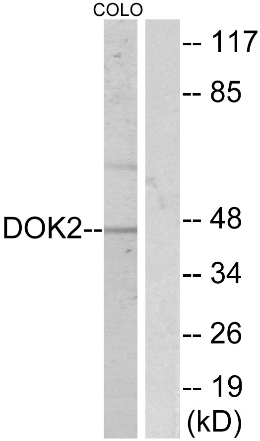 DOK2 Antibody - Western blot analysis of lysates from COLO205, using p56 Dok-2 Antibody. The lane on the right is blocked with the synthesized peptide.