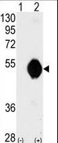 DOK2 Antibody - Western blot of DOK2 (arrow) using DOK2 Antibody. 293 cell lysates (2 ug/lane) either nontransfected (Lane 1) or transiently transfected with the DOK2 gene (Lane 2) (Origene Technologies).