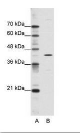 DOK2 Antibody - A: Marker, B: HepG2 Cell Lysate.  This image was taken for the unconjugated form of this product. Other forms have not been tested.