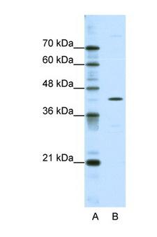 DOK2 Antibody - DOK2 antibody Western blot of HepG2 Cell lysate. Antibody concentration 1 ug/ml. This image was taken for the unconjugated form of this product. Other forms have not been tested.