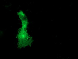 DOK2 Antibody - Anti-DOK2 mouse monoclonal antibody immunofluorescent staining of COS7 cells transiently transfected by pCMV6-ENTRY DOK2.