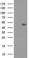 DOK2 Antibody - HEK293T cells were transfected with the pCMV6-ENTRY control (Left lane) or pCMV6-ENTRY DOK2 (Right lane) cDNA for 48 hrs and lysed. Equivalent amounts of cell lysates (5 ug per lane) were separated by SDS-PAGE and immunoblotted with anti-DOK2.