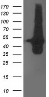 DOK2 Antibody - HEK293T cells were transfected with the pCMV6-ENTRY control (Left lane) or pCMV6-ENTRY DOK2 (Right lane) cDNA for 48 hrs and lysed. Equivalent amounts of cell lysates (5 ug per lane) were separated by SDS-PAGE and immunoblotted with anti-DOK2.