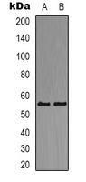 DOK2 Antibody - Western blot analysis of DOK2 expression in Jurkat (A); K562 (B) whole cell lysates.
